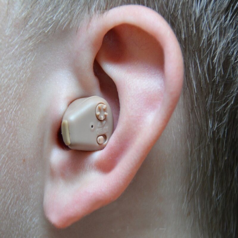 axon к-88 аккумуляторная слуховые аппараты в ухо.